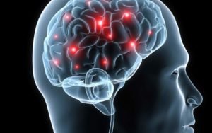 20s11brain-thumb-large