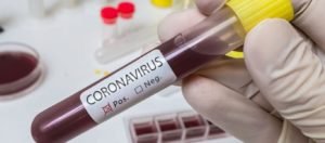 coronavirus-blood-test