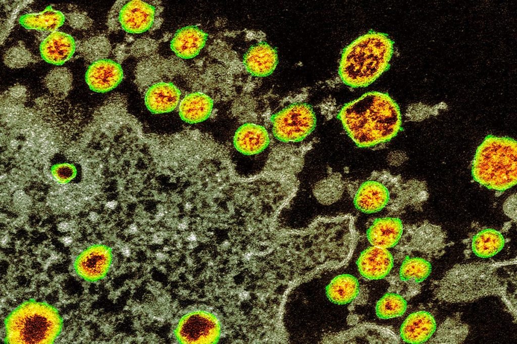 c0482483-covid-19_coronavirus_tem_web