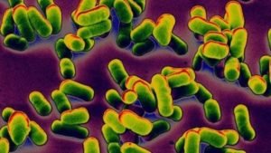 30160760_plague