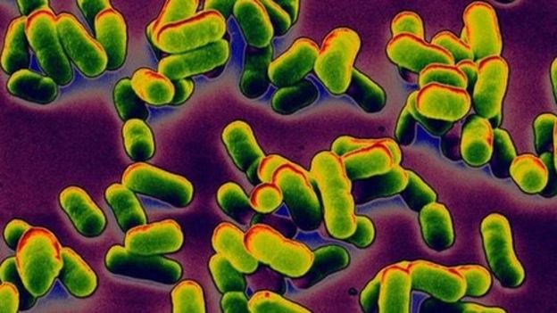 30160760_plague