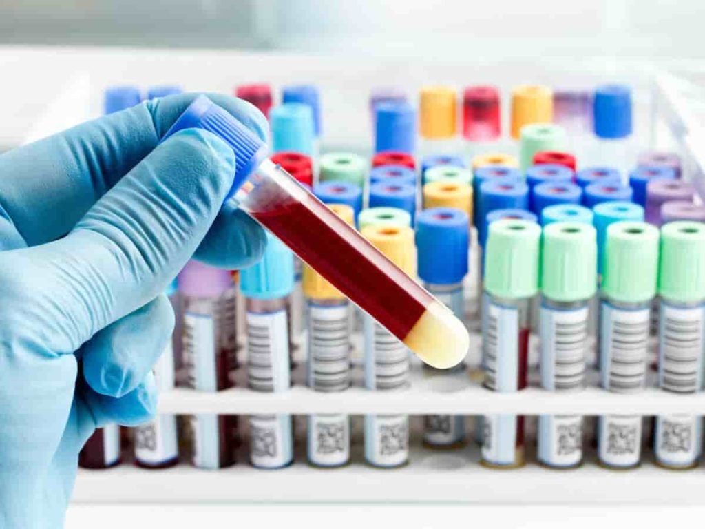 blood test aima