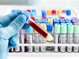 blood test aima