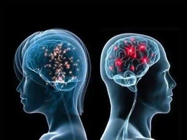 brain male female human