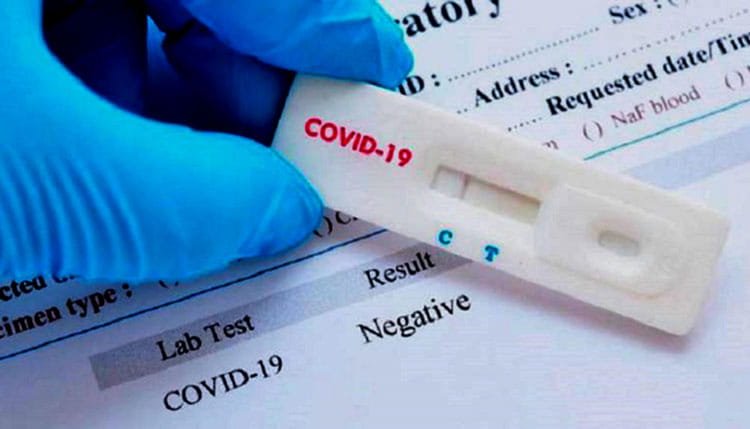 COVID-19-test-min