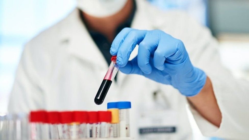 blood test