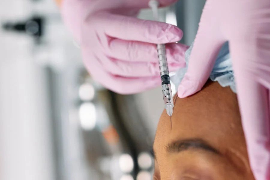 botox beauty